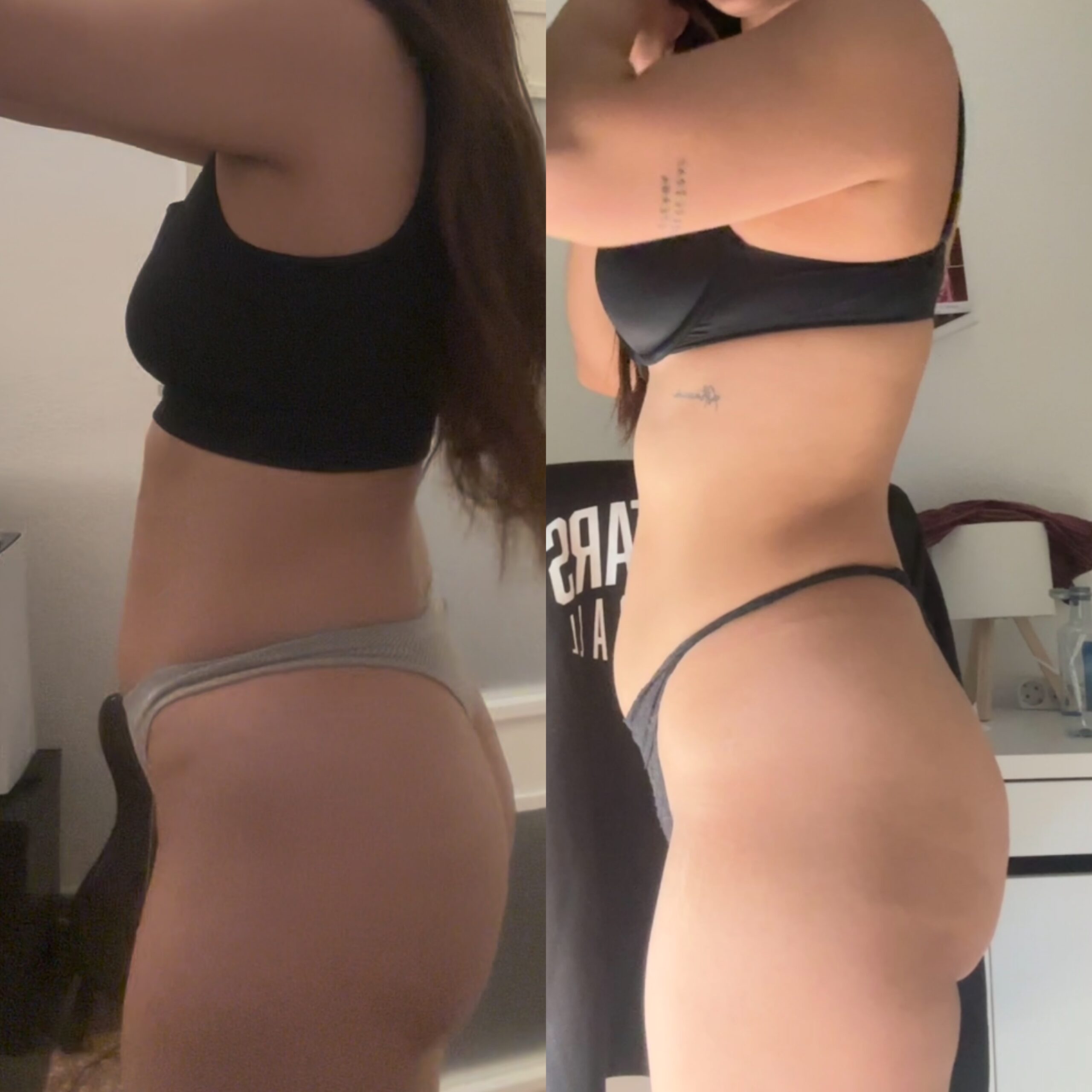 Antes y después de 1 mes desinflamatorio